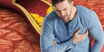 المجلس الصحي السعودي يطلق توصيات جديدة للوقاية من ارتفاع “الدهون الثلاثية”