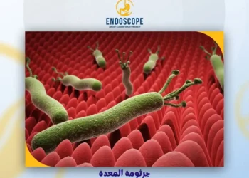 «مختص»: جرثومة المعدة من أكثر الأمراض المعدية على مستوى العالم