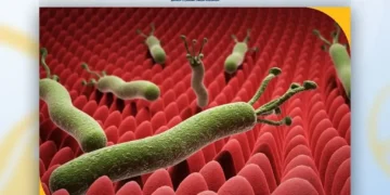 «مختص»: جرثومة المعدة من أكثر الأمراض المعدية على مستوى العالم