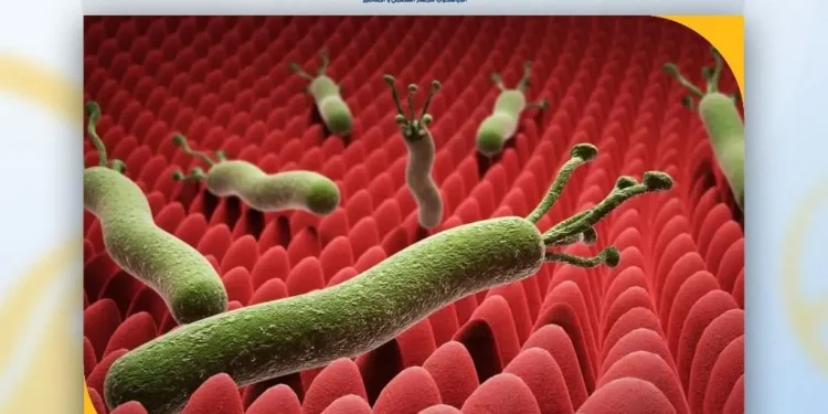 «مختص»: جرثومة المعدة من أكثر الأمراض المعدية على مستوى العالم