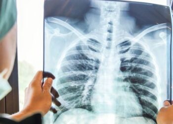 «محاصرته والقضاء عليه».. الصحة العالمية تحتفي باليوم العالمي لمكافحة السل