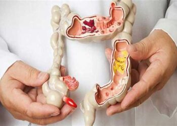 أعراض لا تتجاهلها.. قد تكون مؤشرًا لسرطان القولون والمستقيم