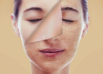 نصائح ذهبية للعناية بالبشرة الجافة في حرارة الصيف اللافحة