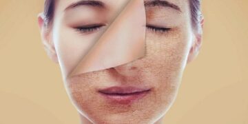 نصائح ذهبية للعناية بالبشرة الجافة في حرارة الصيف اللافحة