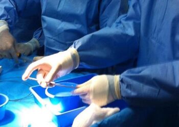 نجاح أول عملية لعلاج الرجفان الأذيني بالشرقية في مستشفى الملك فهد الجامعي