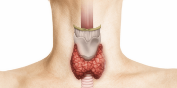 اضطرابات الغدة الدرقية: الأعراض والتشخيص والعلاج