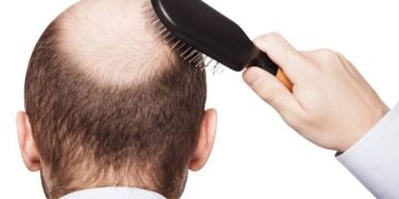 يكافح الثعلبة والتساقط.. اكتشاف بروتين جديد يعالج بصيلات الشعر