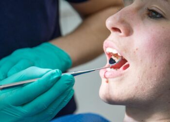 بينها الإصابة بالسكري.. عوامل تمنع زرع الأسنان