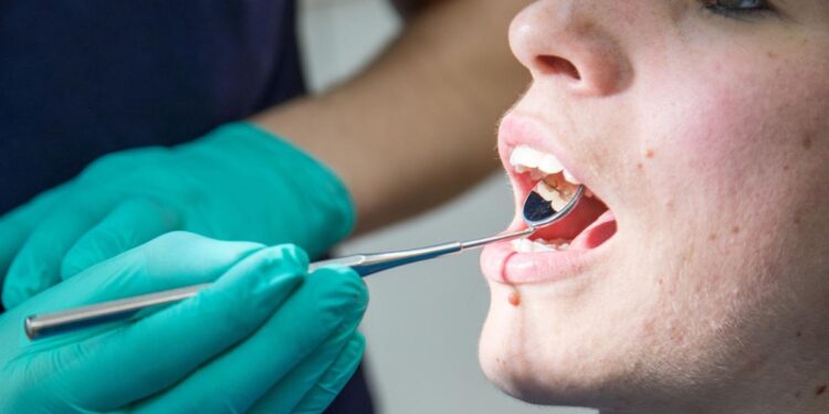 بينها الإصابة بالسكري.. عوامل تمنع زرع الأسنان