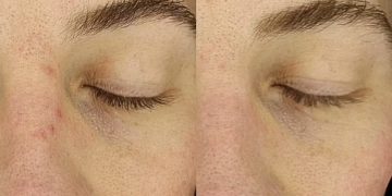 كميائي حائز على نوبل يخترع قناع ثوري للتجميل