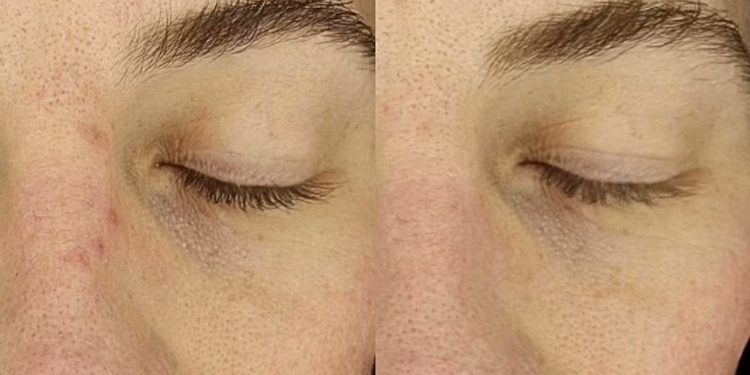 كميائي حائز على نوبل يخترع قناع ثوري للتجميل