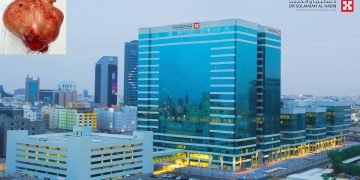 بطول 24 سم.. إنجاز طبي سعودي يُنقذ سيدة من ورم ضخم كاد أن يهدد حياتها