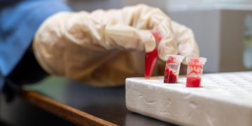 الأنسولين “صُنع في السعودية”.. الحلم يقترب من التحقق