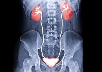 سابقة تاريخية في الطب.. نجاح عملية زرع مثانة بشرية لمريض