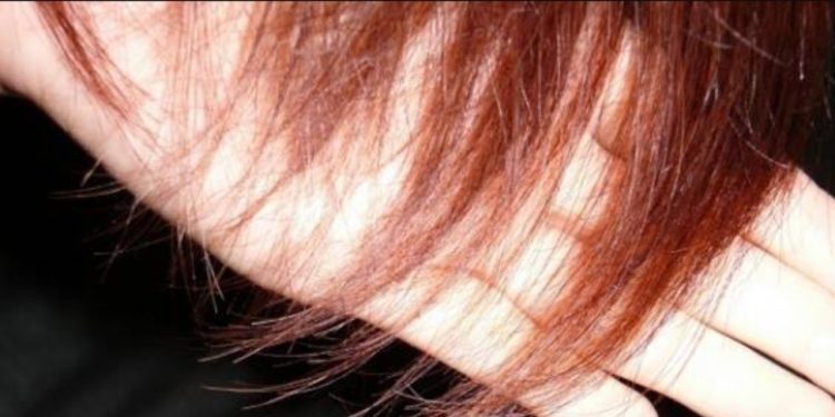 أشعة الشمس تهاجم شعركِ هذا الصيف.. ونصائح بسيطة تحميه وتمنحه تألقًا