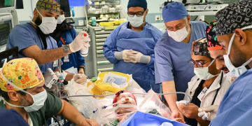 فصل التوأم السيامي "يارا ولارا"