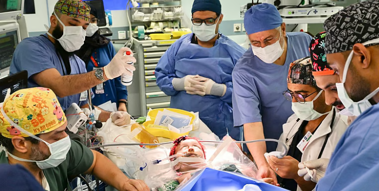 فصل التوأم السيامي