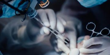 إنجاز طبي غير مسبوق.. استئصال ورم دماغي بتقنية “الجمجمة المفتوحة أثناء اليقظة”