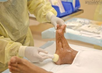 أمل جديد لآلاف المرضى.. مستشفى دكتور سليمان الحبيب يُطلق مركزاً لعلاج “القدم السكرية والجروح المزمنة”
