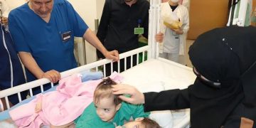 السعودية تبدأ عملية فصل التوأم السيامي السوري “سيلين وإيلين” وسط ترقب إنساني عالمي