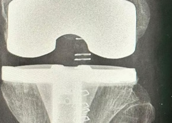 مستشفى الدرعية