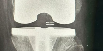 مستشفى الدرعية