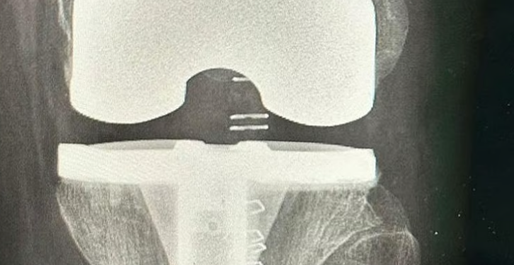 مستشفى الدرعية