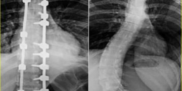 عملية جراحية