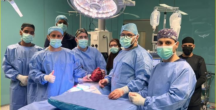 استئصال ورم ضخم يزن أكثر من 3 كجم في مدينة الملك سلمان الطبية