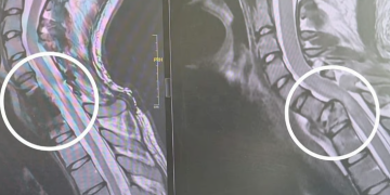 我的新医学成就