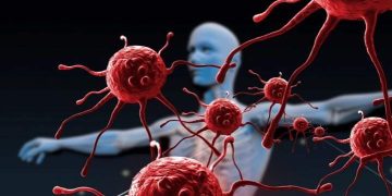 مسكن شائع يحمل خصائص محتملة تعالج للسرطان