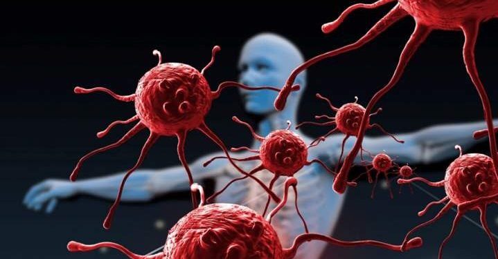 مسكن شائع يحمل خصائص محتملة تعالج للسرطان