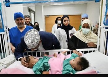 فريق طبي سعودي يبدأ عملية معقدة لفصل التوأم السيامي “رحمة ورملا” في الرياض
